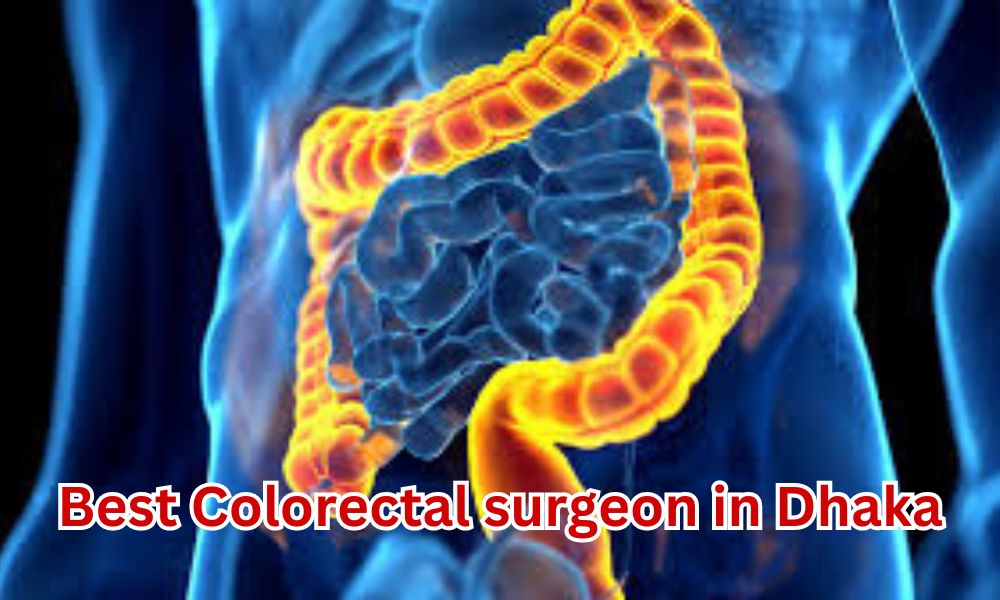 Best Colorectal surgeon in Dhaka.
